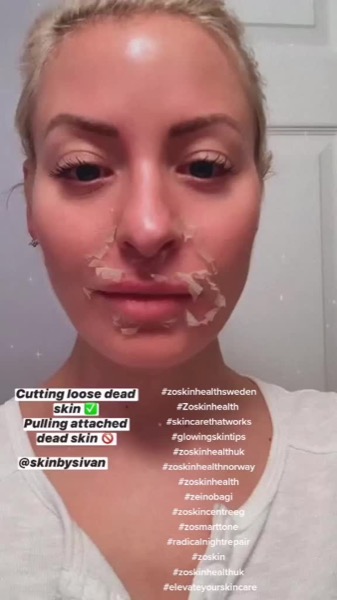 Post by zoskinhealth.jo