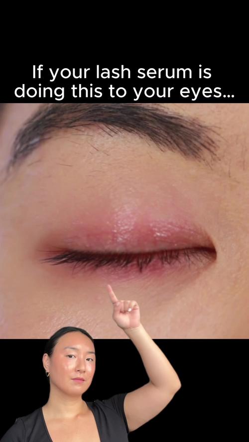 Post by trytwentytwenty