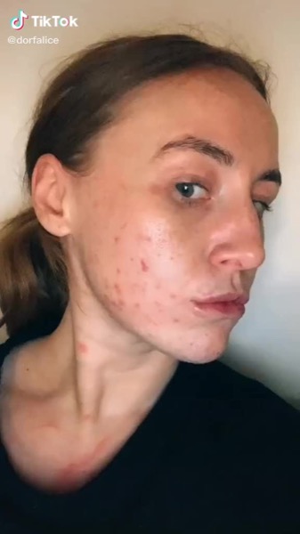 Post by zoskinhealth.jo