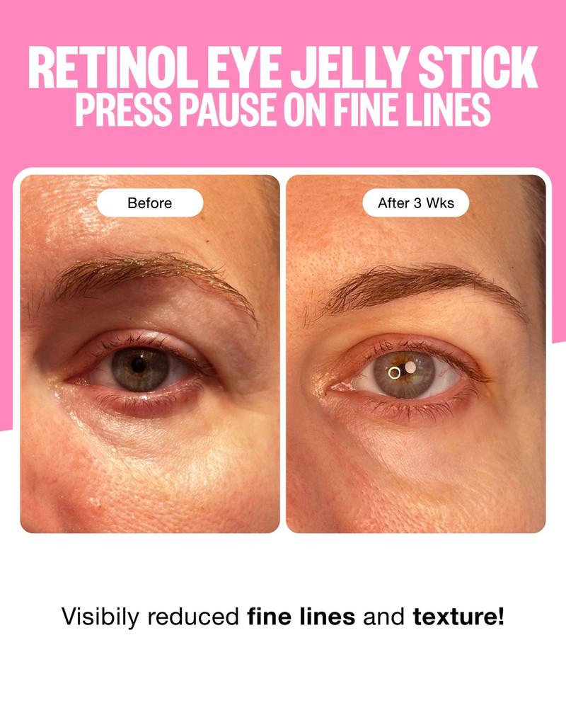 Post by peaceoutskincare