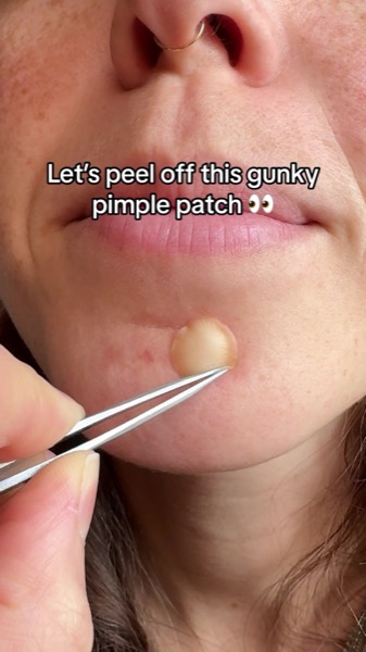 Post by peaceoutskincare