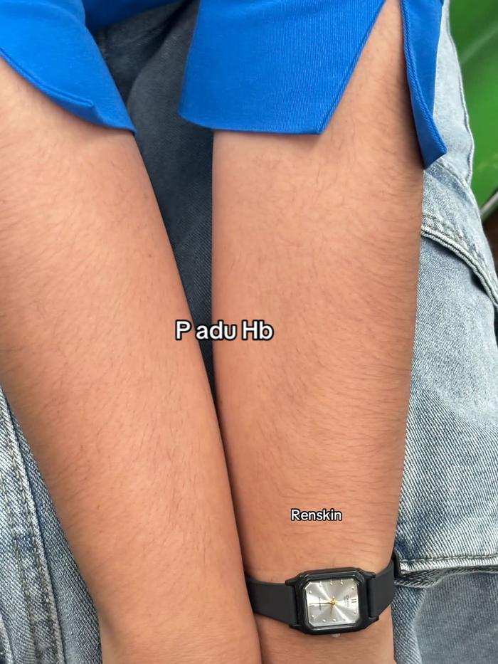 TikTok Post Thumbnail