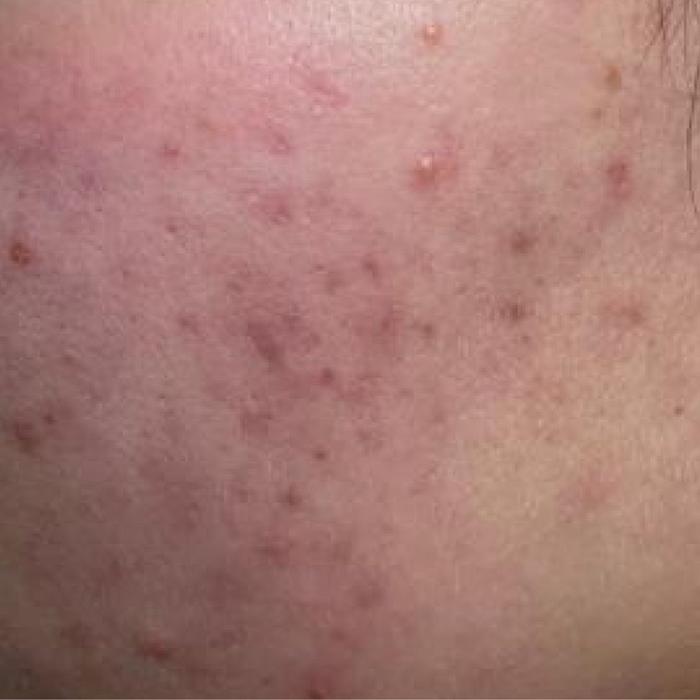 TikTok Post Thumbnail