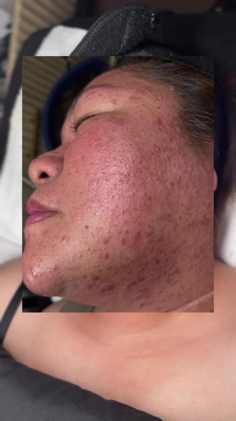 TikTok Post Thumbnail