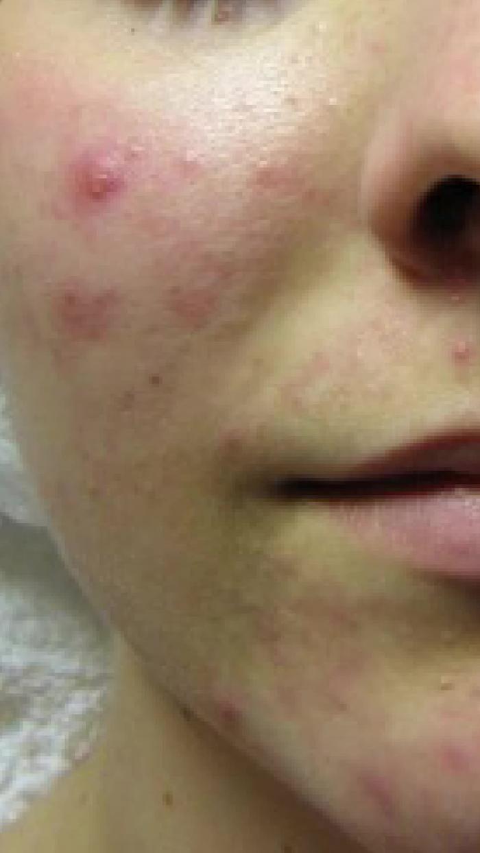 TikTok Post Thumbnail