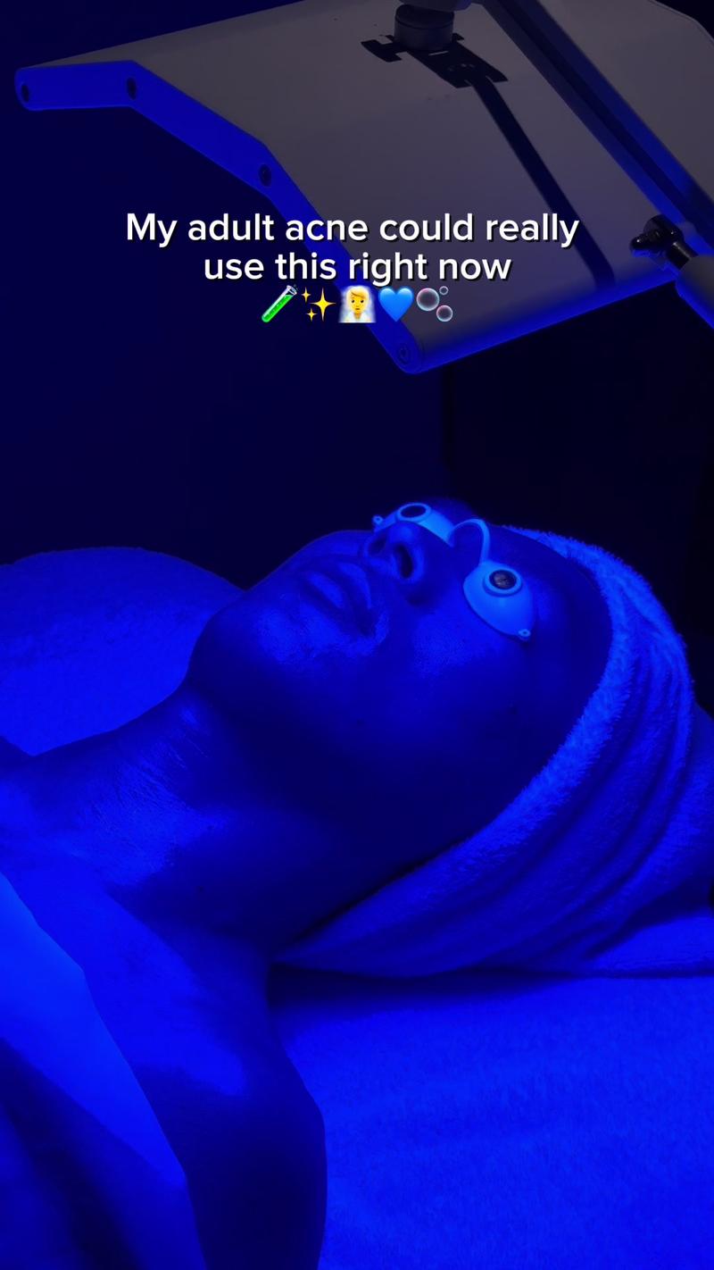 TikTok Post Thumbnail