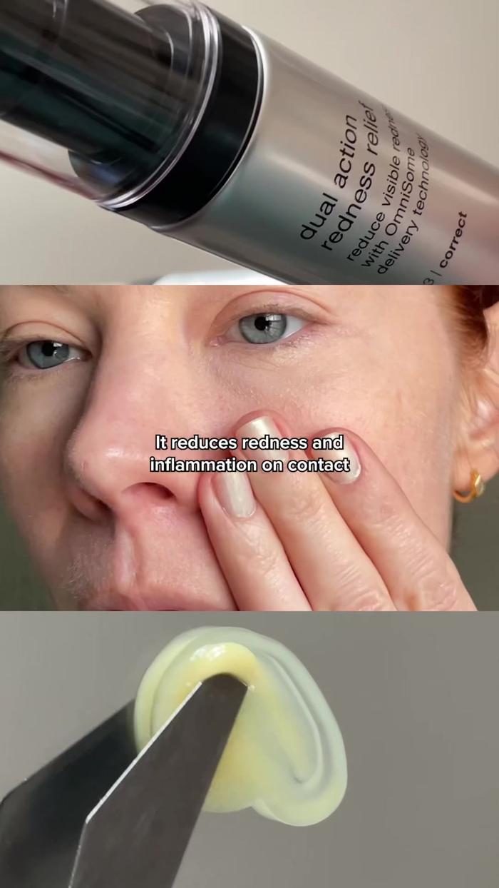 Post by officialpcaskin