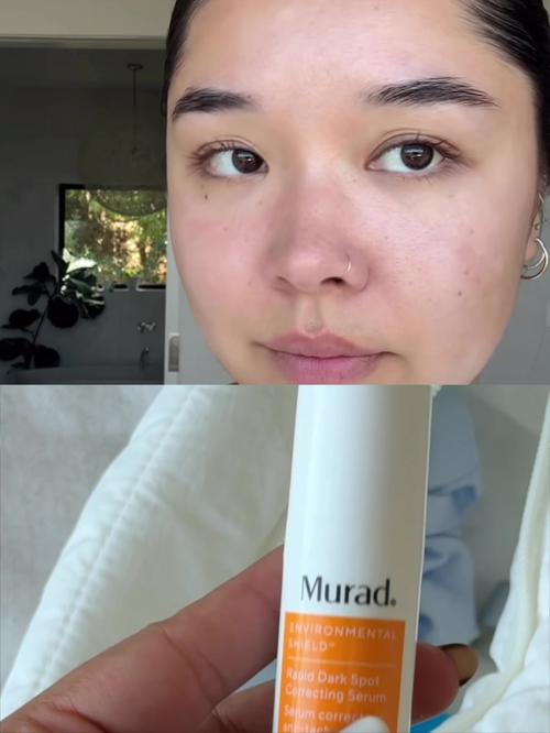 Post by muradskincare