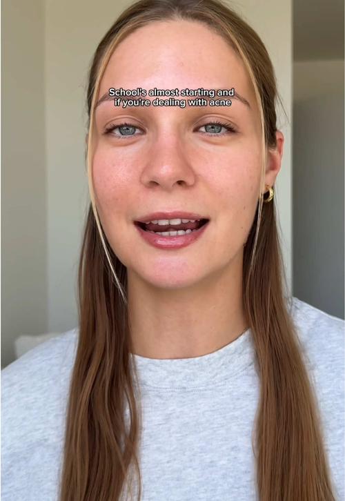 Post by larocheposayus