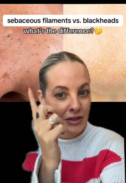 Post by katesomervilleskincare