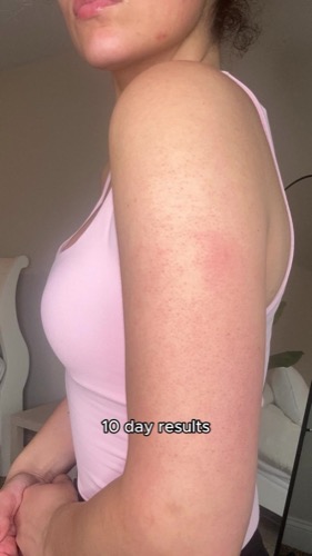 Post by firstaidbeauty