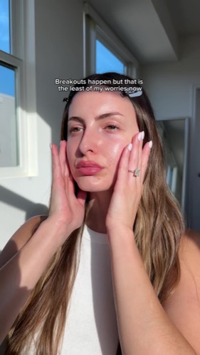 Post by larocheposayus