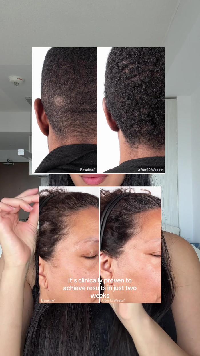 TikTok Post Thumbnail