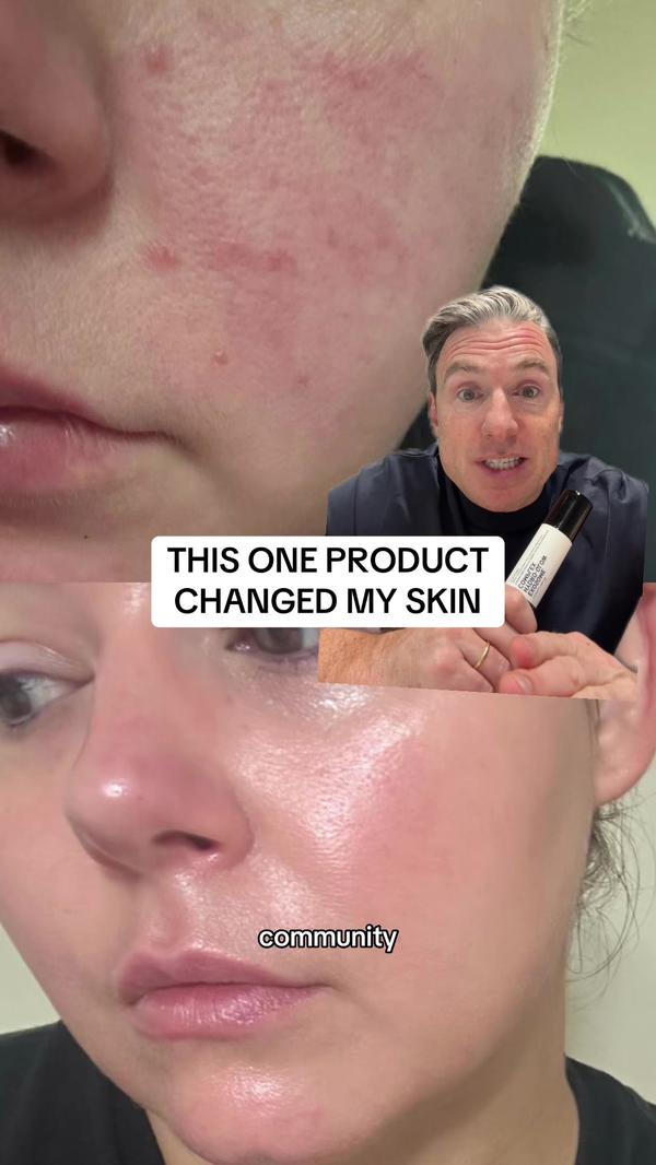 Post by theinkeylist