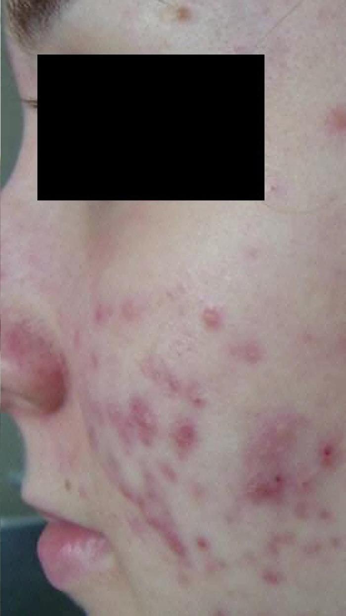 TikTok Post Thumbnail