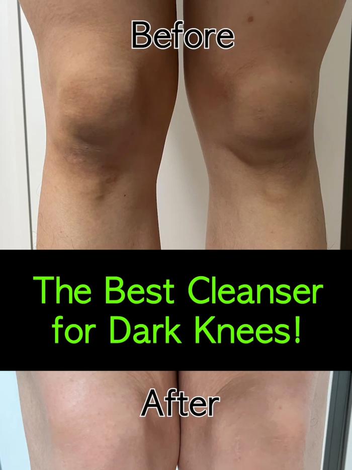 Post by somebymi.official