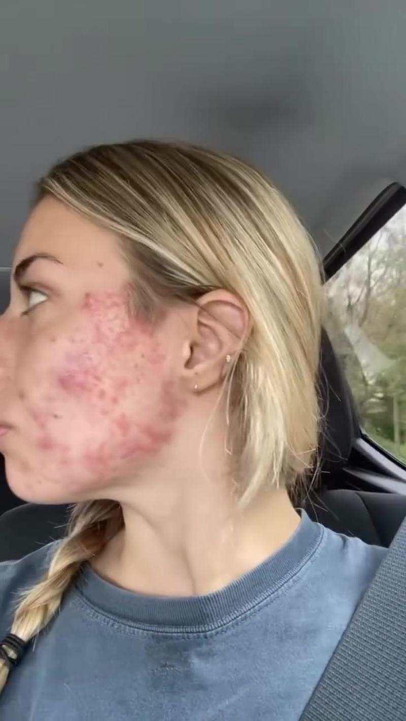 TikTok Post Thumbnail