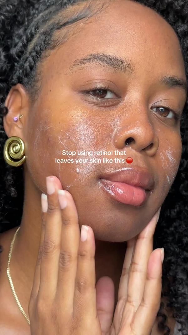 Post by koraorganics