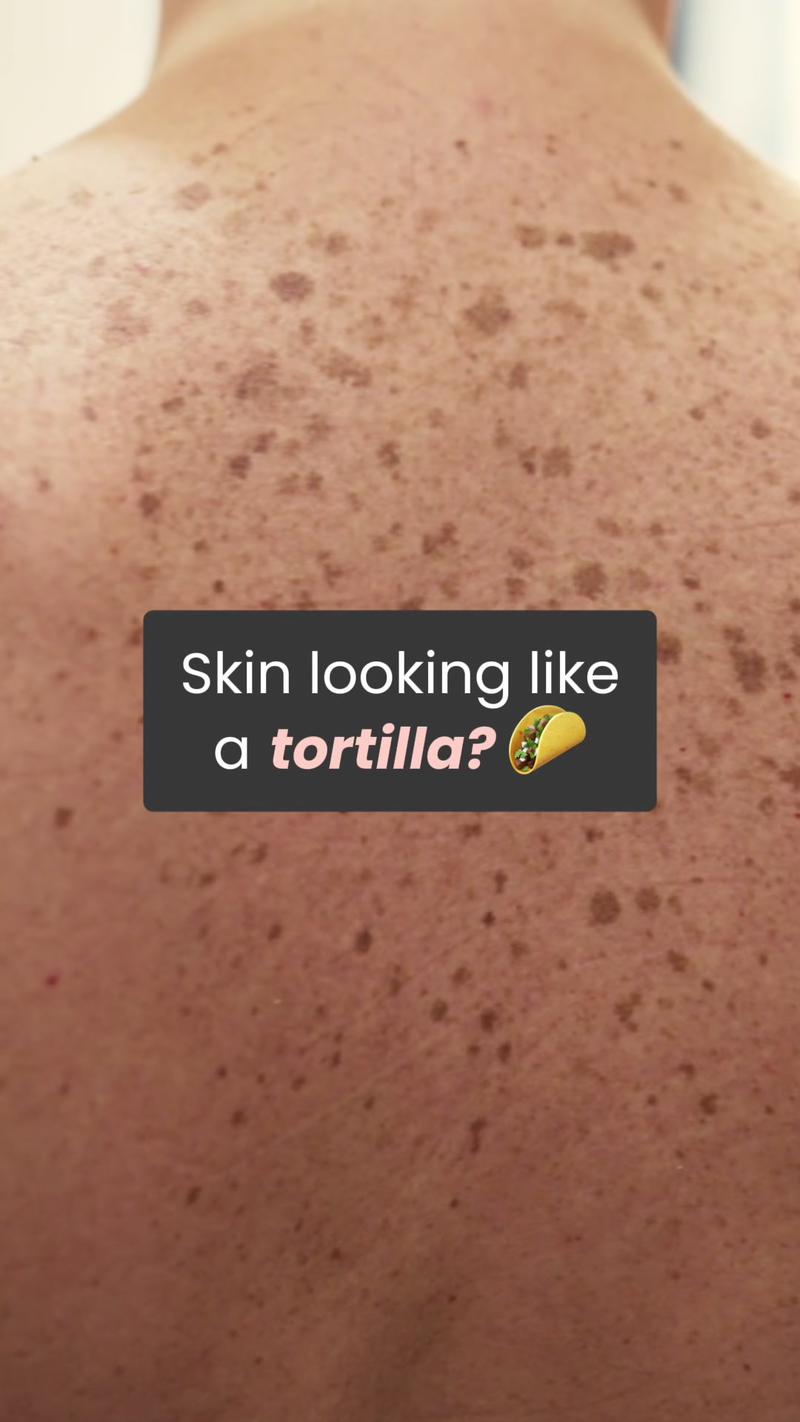 TikTok Post Thumbnail