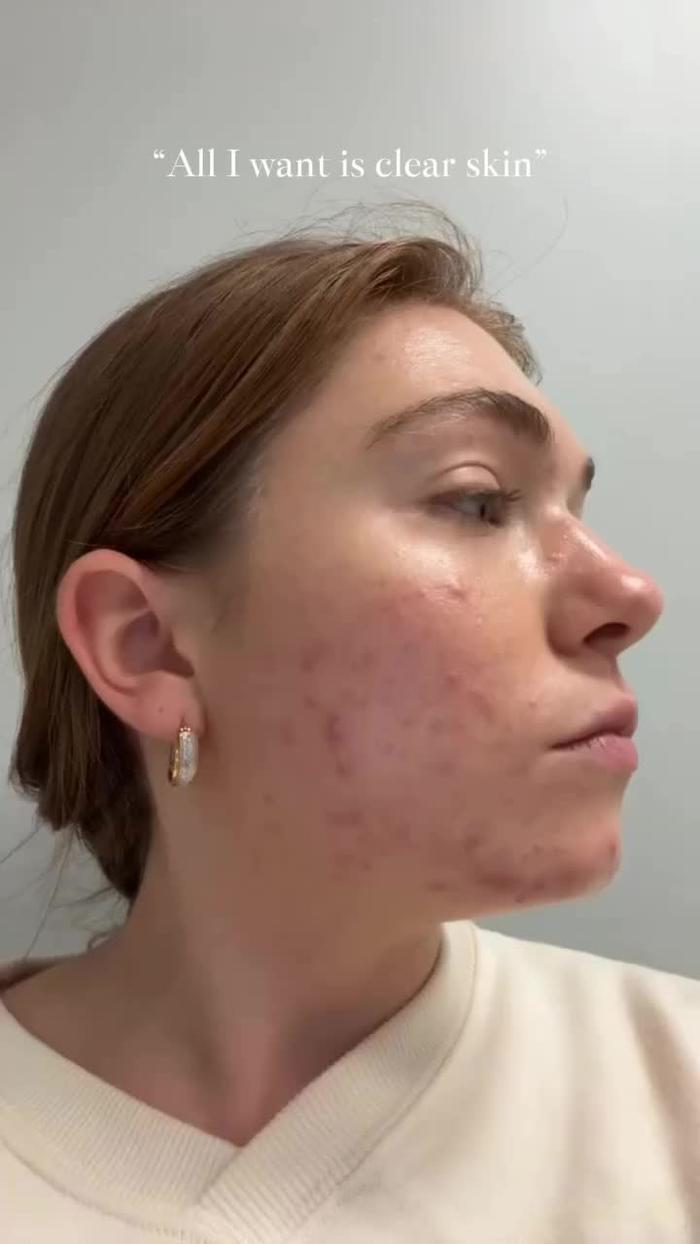 TikTok Post Thumbnail