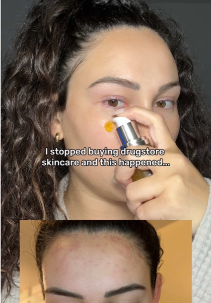 TikTok Post Thumbnail