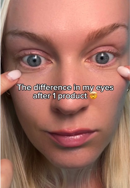 TikTok Post Thumbnail