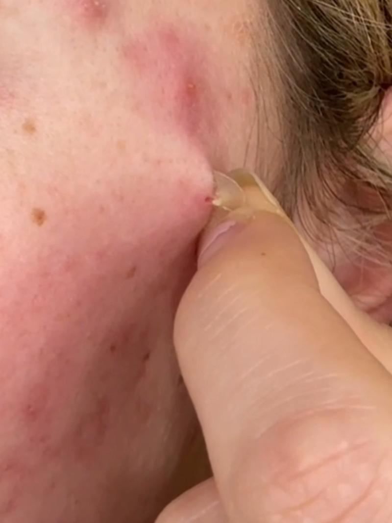 TikTok Post Thumbnail