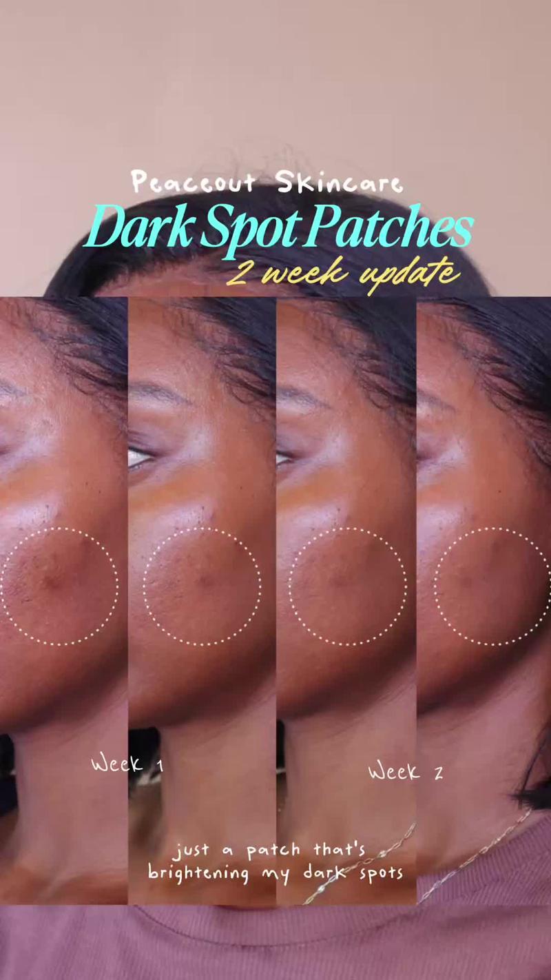 Post by peaceoutskincare