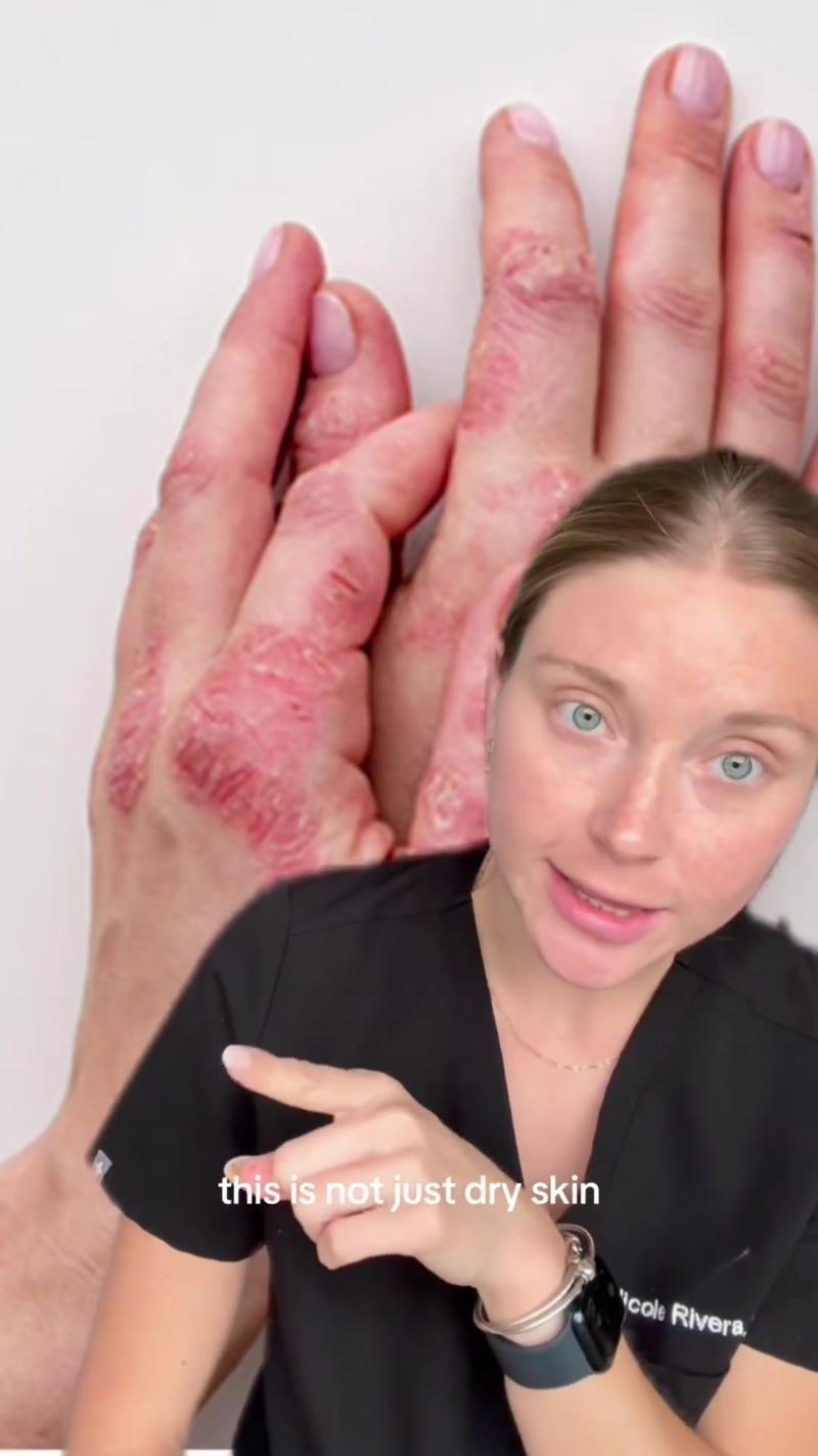 Post by firstaidbeauty