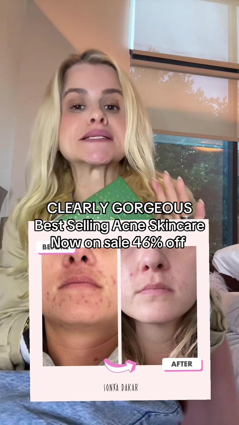 TikTok Post Thumbnail