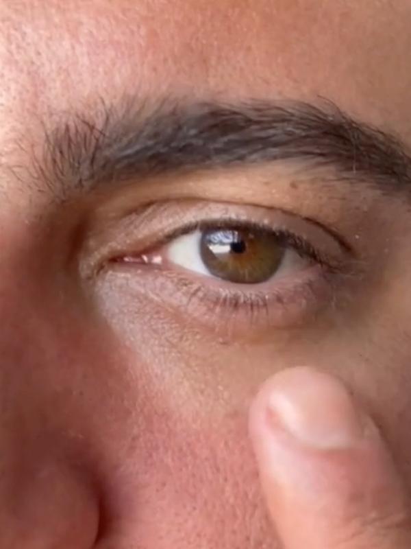 TikTok Post Thumbnail