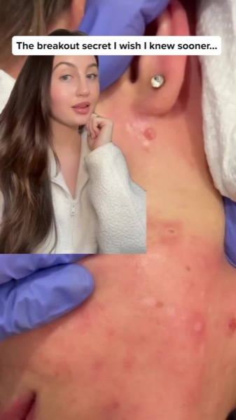 TikTok Post Thumbnail