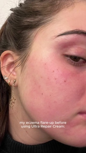 Post by firstaidbeauty