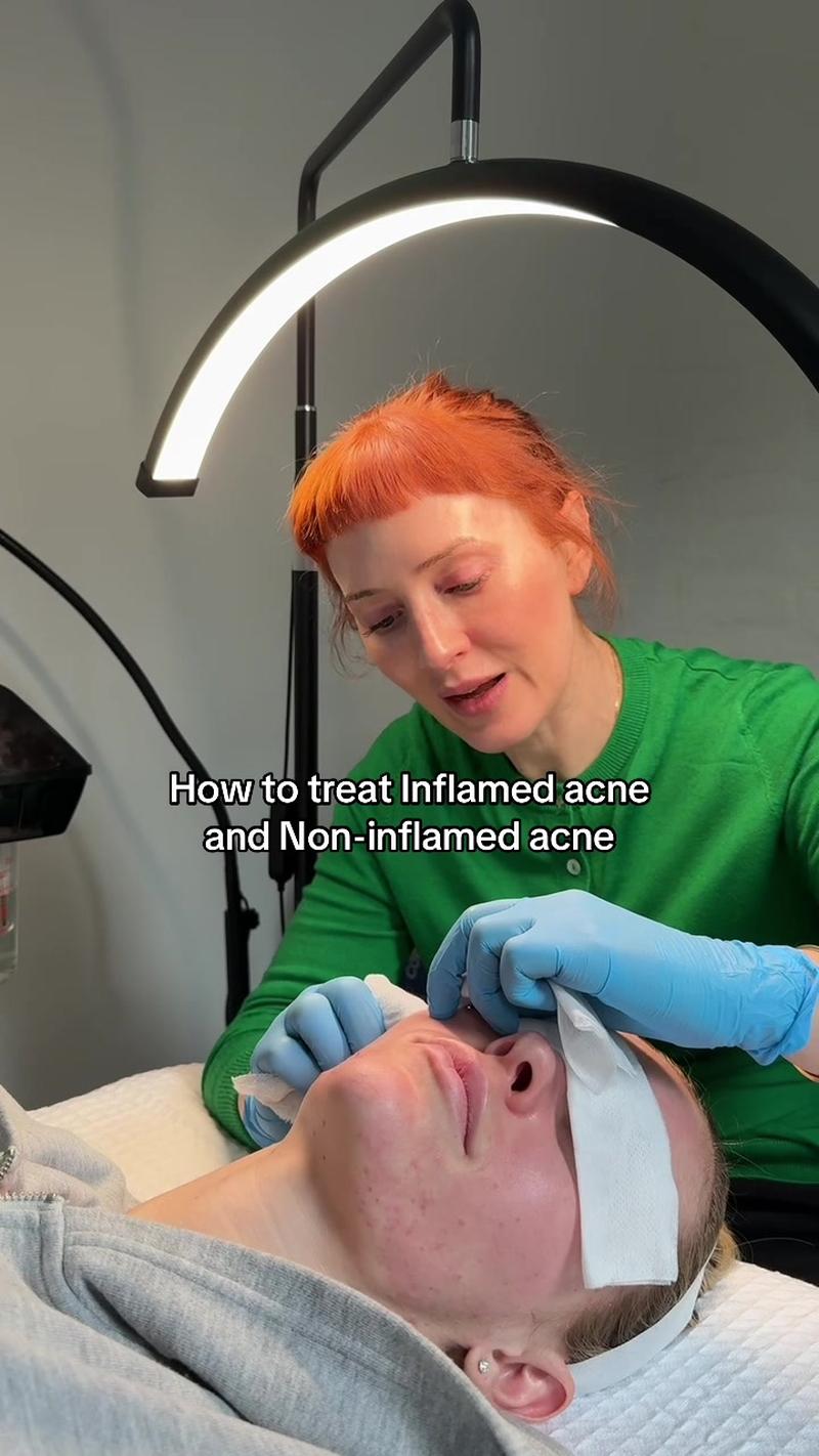 TikTok Post Thumbnail