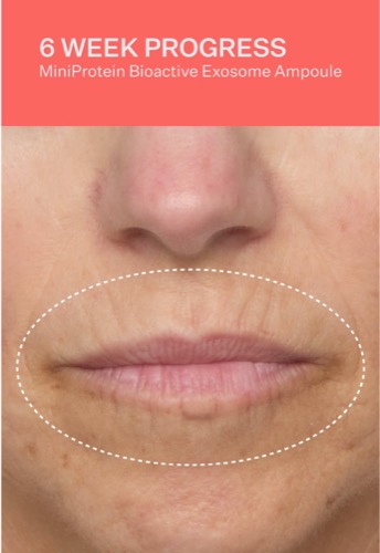 Post by peachandlilyofficial