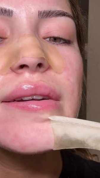 Post by peaceoutskincare