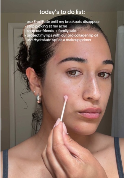 Post by katesomervilleskincare