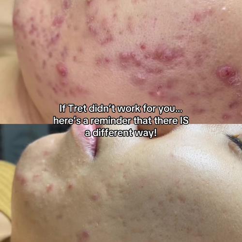 Post by sofiepavittface