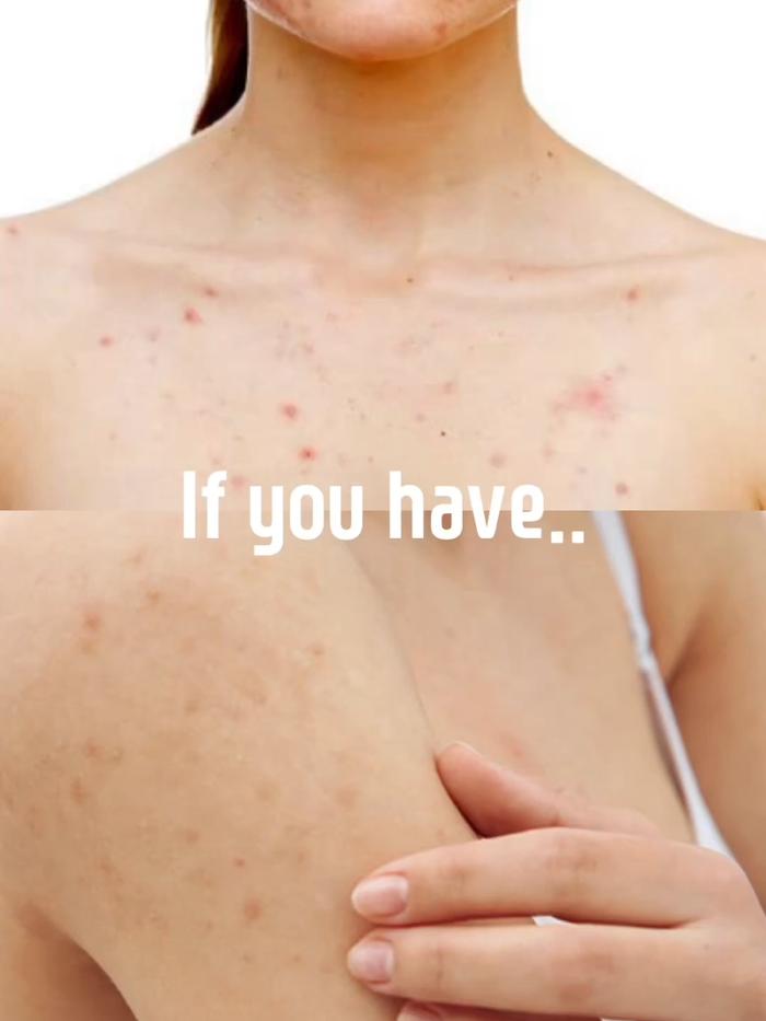 Post by somebymi.official