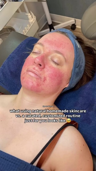 Post by facerealityskincare