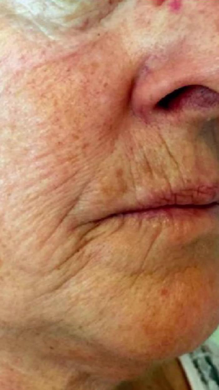 TikTok Post Thumbnail