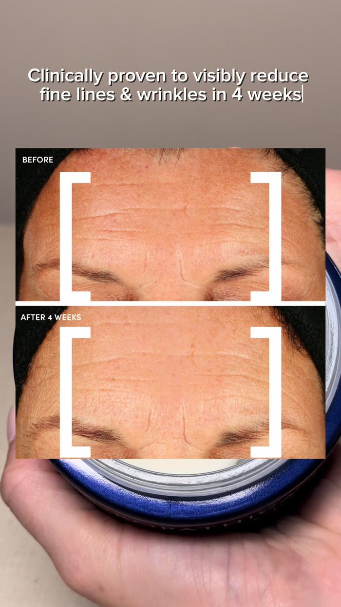 TikTok Post Thumbnail