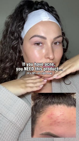 TikTok Post Thumbnail