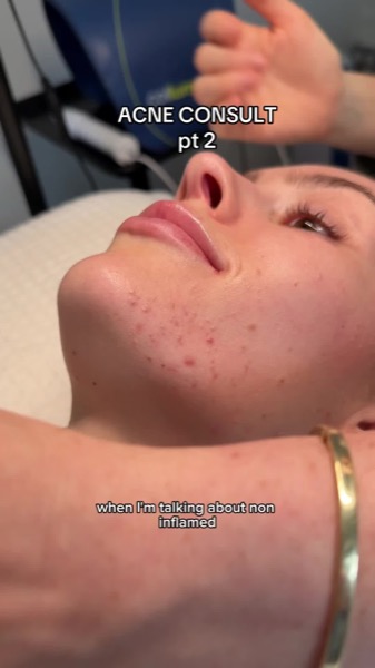 Post by sofiepavittface