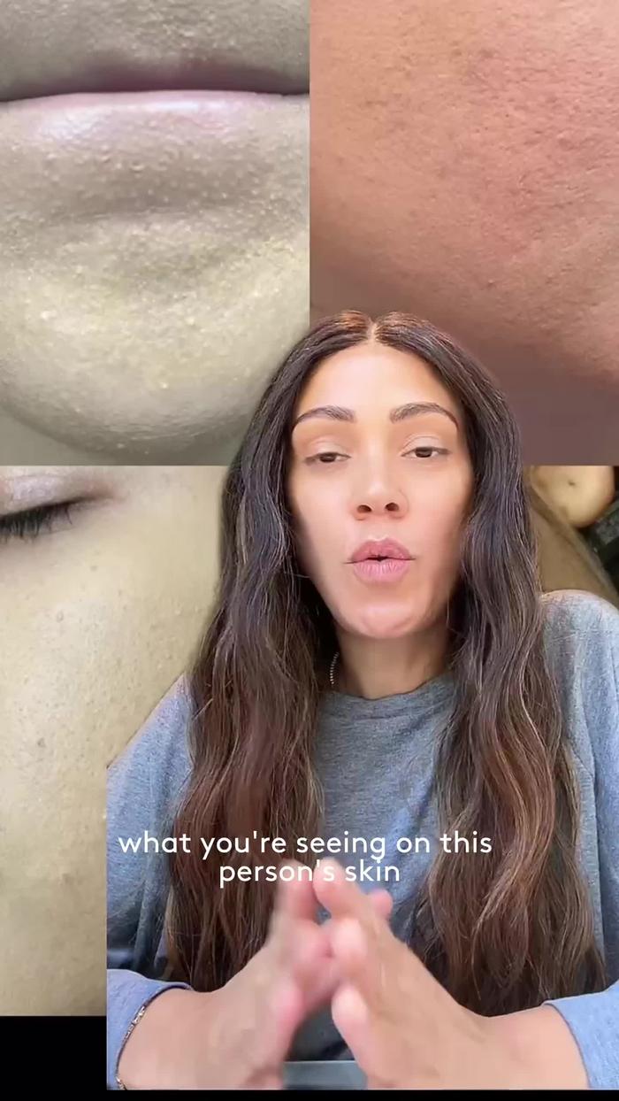 TikTok Post Thumbnail