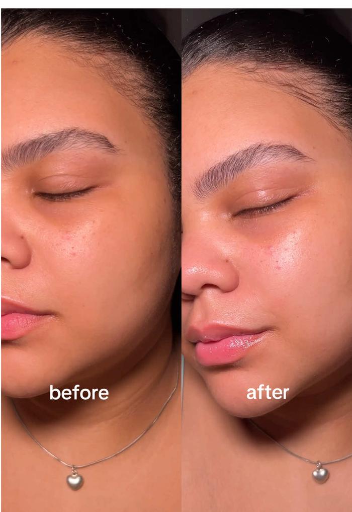 TikTok Post Thumbnail