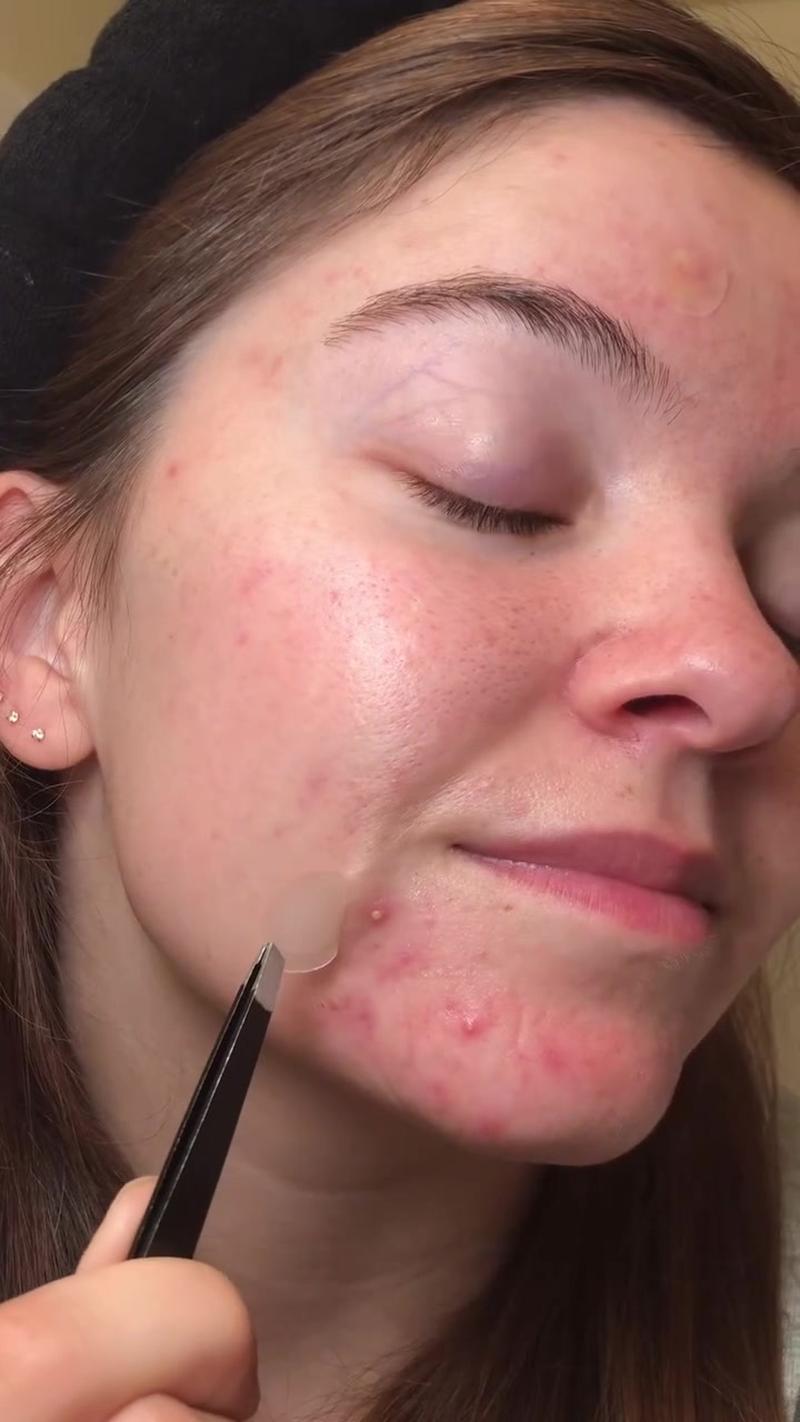 Related Post Thumbnail