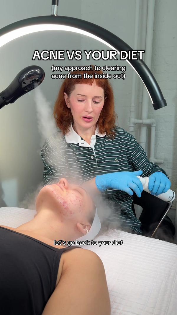 Post by sofiepavittface