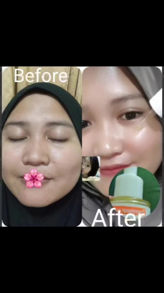 Post by renskincare