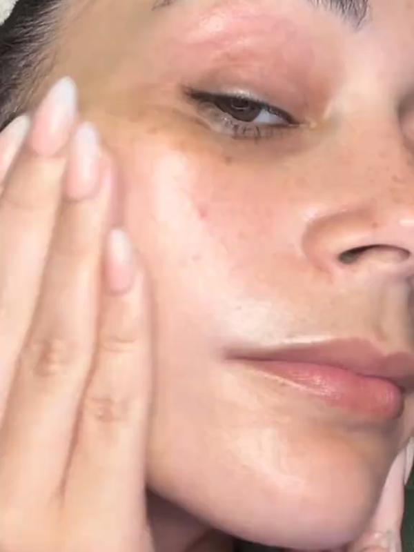 Post by saturdayskin